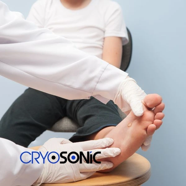 Are you looking for fast effective wart removal Contact us today Chertsey